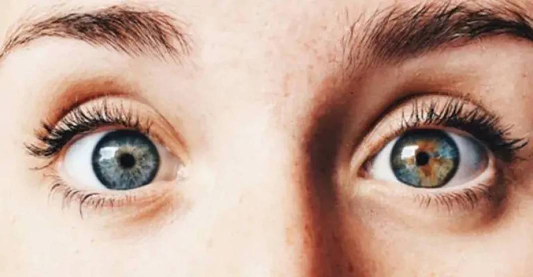 Bu fiziksel özelliklere sahipseniz şanslı azınlıktasınız! Doğuştan geliyor ve nadir bulunuyor 6